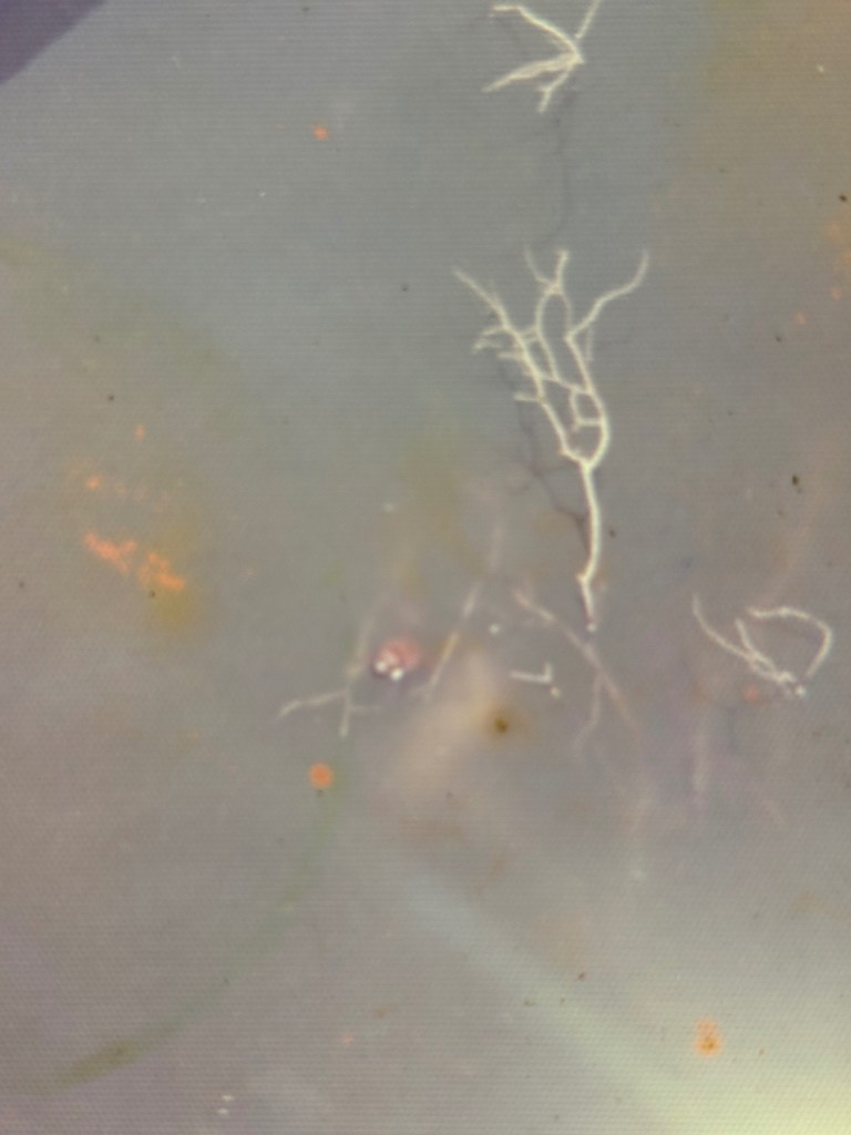 An underwater view showing organic materials like roots and particles floating in murky water.